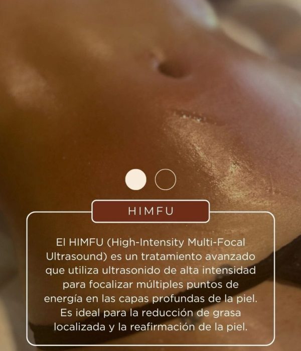 HIMFU