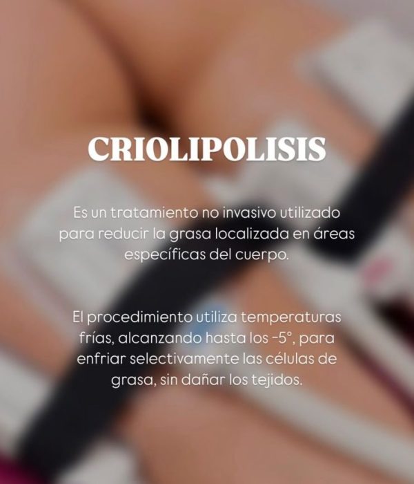 Criolipolisis